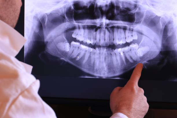 Best Mobile Emergency Dentist in Langhorne, PA